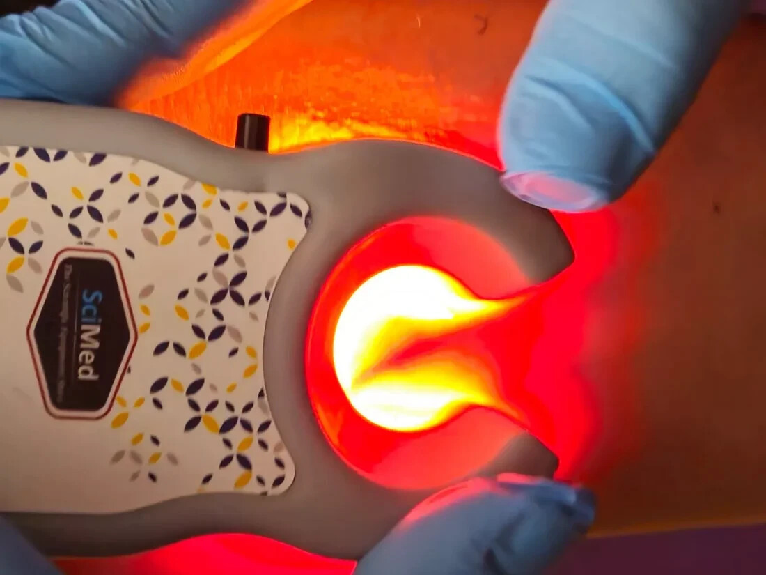 Vein Finder RECHARGEABLE 45 Days Battery Backup 20 Bright LEDs FDA APPROVED
